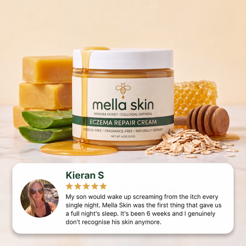 Mella Skin Eczema Cream
